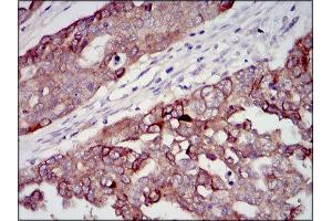 Immunohistochemistry (IHC) image for anti-Insulin-Like Growth Factor 2 (IGF2) (AA 25-180) antibody (ABIN1846026) (IGF2 antibody  (AA 25-180))