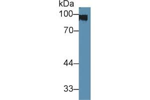 Detection of CK1 in Rat Skin lysate using Polyclonal Antibody to Cytokeratin 1 (CK1) (Cytokeratin 1 antibody  (AA 189-497))