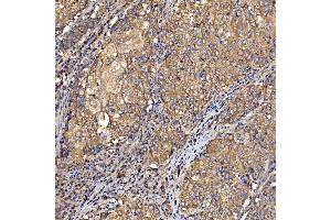 IHC analysis of TTLL2 using anti-TTLL2 antibody (ABIN7600850). (TTLL2 antibody  (AA 24-582))