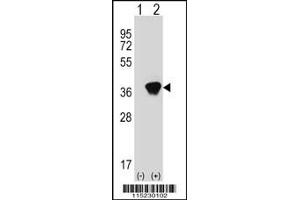 Western blot analysis of AKR1A1 using rabbit polyclonal AKR1A1 Antibody using 293 cell lysates (2 ug/lane) either nontransfected (Lane 1) or transiently transfected (Lane 2) with the AKR1A1 gene. (AKR1A1 antibody  (C-Term))