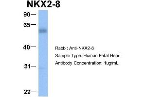 Host:  Rabbit  Target Name:  NKX2-8  Sample Type:  Human Fetal Heart  Antibody Dilution:  1. (NKX2-8 antibody  (C-Term))