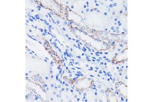 Immunohistochemistry of paraffin-embedded Rat kidney using EPN1 Rabbit pAb (ABIN7267000) at dilution of 1:100 (40x lens). (Epsin 1 antibody  (AA 130-180))