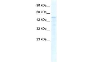 Western Blotting (WB) image for anti-Thyroid Hormone Receptor Interactor 10 (TRIP10) antibody (ABIN2460889) (TRIP10 antibody)