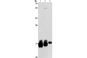 Western Blotting (WB) image for anti-Interferon-Induced Transmembrane Protein 3 (IFITM3) antibody (ABIN2422691) (IFITM3 antibody)