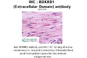 Image no. 1 for anti-Bradykinin Receptor B1 (BDKRB1) (2nd Extracellular Domain) antibody (ABIN1732269) (BDKRB1 antibody  (2nd Extracellular Domain))