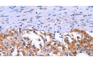 Immunohistochemistry (IHC) image for anti-Anoctamin 1, Calcium Activated Chloride Channel (ANO1) antibody (ABIN7002623)