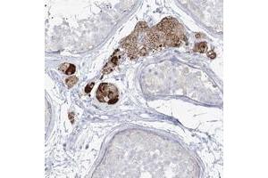 Immunohistochemical staining of human testis with ZNF843 polyclonal antibody  shows strong cytoplasmic positivity in Leydig cells. (ZNF843 antibody)