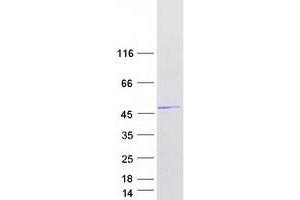 Validation with Western Blot (ORC4 Protein (Transcript Variant 3) (Myc-DYKDDDDK Tag))