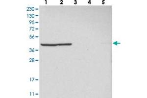 Western blot analysis of Lane 1: RT-4, Lane 2: U-251 MG, Lane 3: Human Plasma, Lane 4: Liver, Lane 5: Tonsil with MRPL37 polyclonal antibody . (MRPL37 antibody)