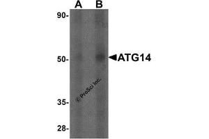 Western Blotting (WB) image for anti-ATG14 Autophagy Related 14 (ATG14) antibody (ABIN1077377) (ATG14 antibody)