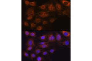 Immunofluorescence analysis of C6 cells using  Rabbit mAb (ABIN7265485) at dilution of 1:100 (40x lens). (ARF6 antibody)