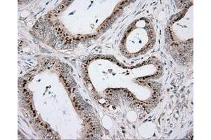 Immunohistochemical staining of paraffin-embedded Kidney tissue using anti-RC203219 mouse monoclonal antibody. (ACSBG1 antibody)