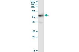 Immunoprecipitation of HKDC1 transfected lysate using anti-HKDC1 monoclonal antibody and Protein A Magnetic Bead , and immunoblotted with HKDC1 monoclonal antibody. (HKDC1 antibody  (AA 1-427))