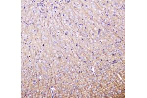 Immunohistochemistry (IHC) image for anti-Microtubule-Associated Protein 1 Light Chain 3 alpha (MAP1LC3A) (AA 1-120) antibody (ABIN5693061)