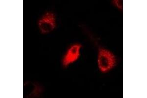 Immunofluorescent analysis of IDE staining in A549 cells. (IDE antibody)