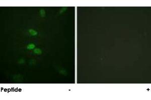 Immunofluorescence analysis of HeLa cells, using CDC25B polyclonal antibody .
