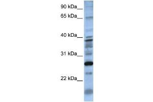 Western Blotting (WB) image for anti-Dolichyl Pyrophosphate Phosphatase 1 (DOLPP1) antibody (ABIN2459296) (DOLPP1 antibody)