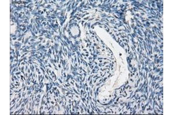 PP5 antibody