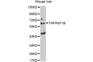 Western blot analysis of extracts of mouse liver, using TNFRSF1B antibody (ABIN6291033) at 1:1000 dilution.