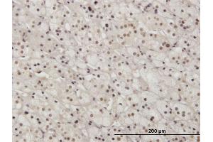 Immunostaining (ISt) image for anti-Paired Box Gene 2a (PAX2A) (AA 194-303) antibody (ABIN562109)