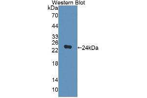 Western blot analysis of the recombinant protein. (DPEP2 antibody  (AA 303-486))
