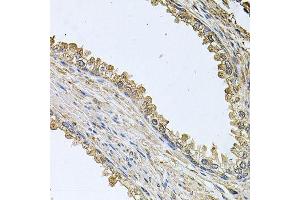 Immunohistochemistry of paraffin-embedded human prostate using MEMO1 antibody (ABIN5995855) at dilution of 1/100 (40x lens). (MEMO1 antibody)