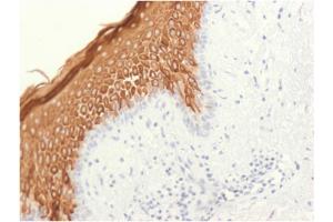 Formalin-fixed, paraffin-embedded human skin stained with Cytokeratin 10 Rabbit Recombinant Monoclonal Antibody (KRT10/1948R). (Recombinant Keratin 10 antibody)