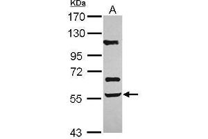 WB Image Sample (30 ug of whole cell lysate) A: U87-MG 7. (ACVR2B antibody  (Center))