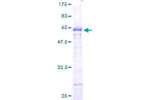 PPP1R3B Protein (AA 1-285) (GST tag)