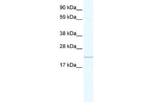 WB Suggested Anti-GTL3 Antibody Titration:  0. (C16orf80 antibody  (C-Term))