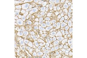 Immunohistochemistry of paraffin-embedded mouse brain using RPGR Rabbit pAb (ABIN3015609, ABIN3015610, ABIN3015611, ABIN1682567 and ABIN6218971) at dilution of 1:50 (40x lens). (RPGR antibody  (AA 1-260))