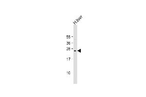Anti-PTTG2 Antibody (Center) at 1:2000 dilution + human liver lysate Lysates/proteins at 20 μg per lane. (PTTG2 antibody  (AA 56-84))