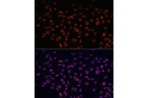 CHD4 antibody  (AA 1520-1690)