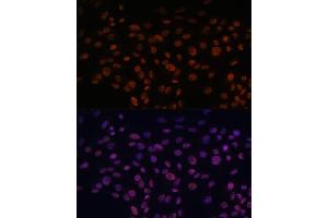 Immunofluorescence analysis of C6 cells using CHD4 antibody (ABIN6127308, ABIN6138512, ABIN6138513 and ABIN6215263) at dilution of 1:100. (CHD4 antibody  (AA 1520-1690))