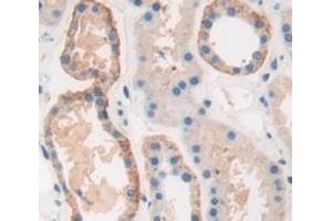 IHC-P analysis of Human Tissue, with DAB staining. (PRSS23 antibody  (AA 20-383))