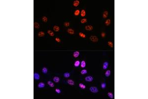 Immunofluorescence analysis of NIH-3T3 cells using P Rabbit mAb (ABIN7269445) at dilution of 1:100 (40x lens). (PABPN1 antibody)