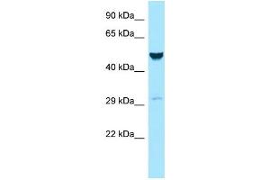 WB Suggested Anti-GALK2 Antibody Titration: 1. (GALK2 antibody  (C-Term))