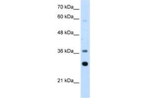 Western Blotting (WB) image for anti-Ribosomal Protein, Large, P0 (RPLP0) antibody (ABIN2462059) (RPLP0 antibody)