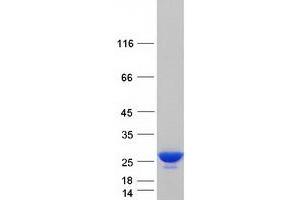 Validation with Western Blot (Peroxiredoxin 2 Protein (PRDX2) (Transcript Variant 1) (Myc-DYKDDDDK Tag))
