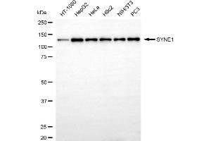 Western blotting analysis using SYNE1 antibody (ABIN7800419). (Recombinant SYNE1 antibody)
