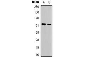 Western blot analysis of Serpin A1 expression in HepG2 (A), NIH3T3 (B) whole cell lysates. (SERPINA1 antibody  (N-Term))
