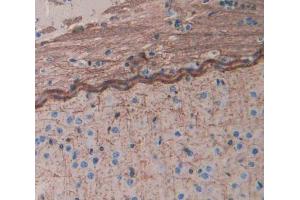 IHC-P analysis of brain tissue, with DAB staining. (Aggrecan antibody  (AA 587-684))