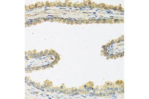 Immunohistochemistry of paraffin-embedded human prostate using CRHBP antibody at dilution of 1:100 (40x lens).