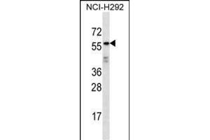 ODF2L Antibody (C-term) (ABIN656938 and ABIN2846129) western blot analysis in NCI- cell line lysates (35 μg/lane). (ODF2L antibody  (C-Term))