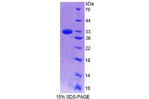 SDS-PAGE (SDS) image for Guanylate Binding Protein 7 (GBP7) (AA 35-277) protein (His tag) (ABIN6239548) (GBP7 Protein (AA 35-277) (His tag))