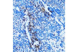 Immunohistochemistry of paraffin-embedded rat spleen using CASP3 antibody (ABIN4903140) at dilution of 1:100 (40x lens). (Caspase 3 antibody)