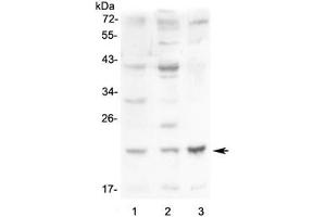 Western blot testing of 1) mouse small intestine, 2) mouse kidney and 3) mouse Neuro-2a lysate with Leptin antibody at 0.