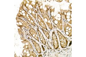 Immunohistochemistry of paraffin-embedded mouse intestin using TOPBP1 Rabbit pAb (ABIN6129493, ABIN6149398, ABIN6149401 and ABIN6221465) at dilution of 1:50 (40x lens). (TOPBP1 antibody  (AA 1253-1522))