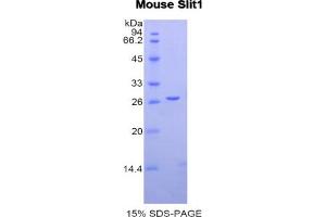 SDS-PAGE analysis of Mouse Slit Homolog 1 Protein. (SLIT1 Protein)