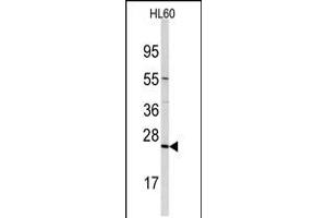 Western blot analysis of anti-TRAPPC4 Antibody in HL60 cell line lysates (35ug/lane)